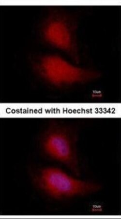 Invitrogen FOXO1 Monoclonal Antibody (14E4) 100 &mu;L; Unconjugated:Antibodies,