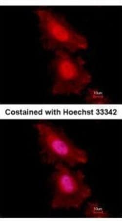 Invitrogen FOXO1 Monoclonal Antibody (7H3) 100 &mu;L; Unconjugated:Antibodies,