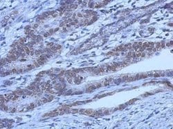 Invitrogen FOXO1 Monoclonal Antibody (7H3) 100 &mu;L; Unconjugated:Antibodies,