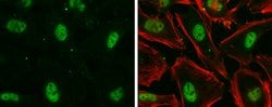 Invitrogen Nuclear Matrix Protein p84 Monoclonal Antibody (5E10) 100 &mu;L;