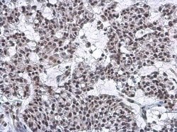 Invitrogen Nuclear Matrix Protein p84 Monoclonal Antibody (5E10) 100 &mu;L;