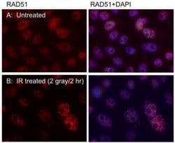 Invitrogen RAD51 Monoclonal Antibody (14B4) 100 &mu;L; Unconjugated:Antibodies,