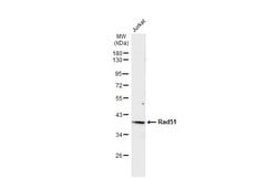 Invitrogen RAD51 Monoclonal Antibody (14B4) 100 &mu;L; Unconjugated:Antibodies,