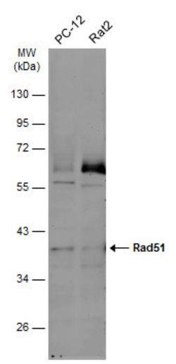 Invitrogen RAD51 Monoclonal Antibody (14B4) 100 &mu;L; Unconjugated:Antibodies,