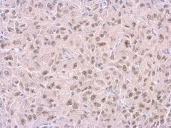 Invitrogen RPA14 Monoclonal Antibody (11.1) 100 &mu;L; Unconjugated:Antibodies,