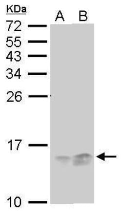 Invitrogen RPA14 Monoclonal Antibody (11.1) 100 &mu;L; Unconjugated:Antibodies,