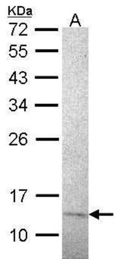Invitrogen RPA14 Monoclonal Antibody (14.2) 100 &mu;L | Buy Online | Invitrogen&trade; | Fisher Scientific