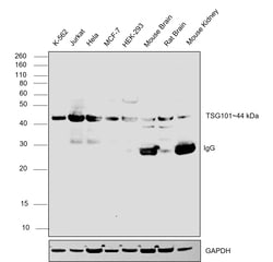 Invitrogen TSG101 Monoclonal Antibody (4A10) 100 &mu;L | Buy Online | Invitrogen&trade; | Fisher Scientific