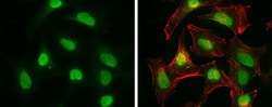 Invitrogen CtIP Monoclonal Antibody (19E8) 100 &mu;L; Unconjugated:Antibodies,