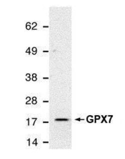 Invitrogen GPX7 Monoclonal Antibody (2704) 100 &mu;L; Unconjugated:Antibodies,