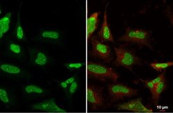 Invitrogen Ku80 Monoclonal Antibody (9403) 100 &mu;L; Unconjugated:Antibodies,