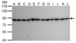 Invitrogen Ku80 Monoclonal Antibody (9403) 100 &mu;L; Unconjugated:Antibodies,