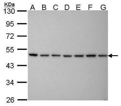 Invitrogen PSMC5 Monoclonal Antibody (25D5) 100 &mu;L; Unconjugated:Antibodies,