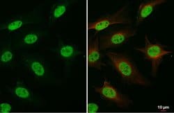 Invitrogen FANCD2 Monoclonal Antibody (103) 100 &mu;L; Unconjugated:Antibodies,