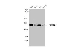Invitrogen FANCD2 Monoclonal Antibody (103) 100 &mu;L; Unconjugated:Antibodies,