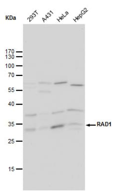 Invitrogen RAD1 Monoclonal Antibody (4126) 100 &mu;L; Unconjugated:Antibodies,