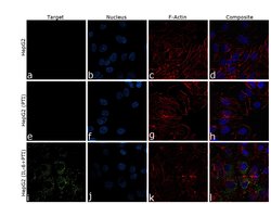 Invitrogen CRP Monoclonal Antibody (C1) 100 &mu;g; Unconjugated:Antibodies,