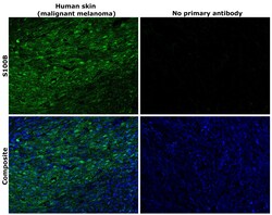 Invitrogen S100B Monoclonal Antibody (SH-B4) 100 &mu;L; Unconjugated:Antibodies,