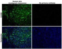 Invitrogen S100B Monoclonal Antibody (SH-B4) 100 &mu;L; Unconjugated:Antibodies,