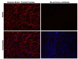 Invitrogen MAP2 Monoclonal Antibody (HM-2) 50 &mu;L; Unconjugated:Anticuerpos