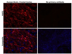 Invitrogen MAP2 Monoclonal Antibody (HM-2) 50 &mu;L; Unconjugated:Anticuerpos