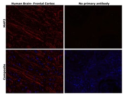 Invitrogen MAP2 Monoclonal Antibody (HM-2) 50 &mu;L; Unconjugated:Anticuerpos