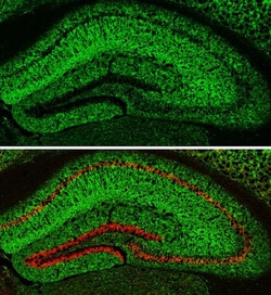 Invitrogen MAP2 Monoclonal Antibody (HM-2) 50 &mu;L; Unconjugated:Antibodies,