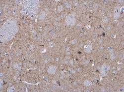Invitrogen MAP2 Monoclonal Antibody (HM-2) 50 &mu;L; Unconjugated:Antibodies,