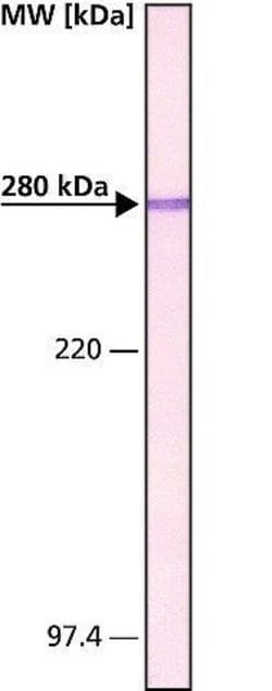 Invitrogen MAP2 Monoclonal Antibody (HM-2) 50 &mu;L; Unconjugated:Antibodies,