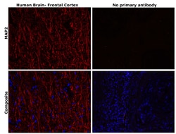 Invitrogen MAP2 Monoclonal Antibody (AP20) 50 &mu;L | Buy Online | Invitrogen&trade; | Fisher Scientific