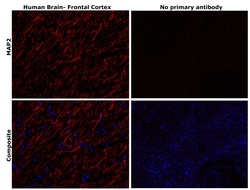 Invitrogen MAP2 Monoclonal Antibody (AP20) 50 &mu;L | Buy Online | Invitrogen&trade; | Fisher Scientific