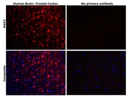 Invitrogen MAP2 Monoclonal Antibody (AP20) 50 &mu;L | Buy Online | Invitrogen&trade; | Fisher Scientific