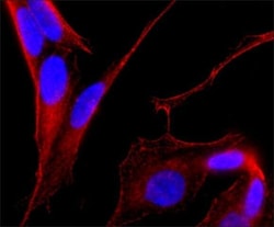 Invitrogen MAP2 Monoclonal Antibody (AP20) 50 &mu;L; Unconjugated:Antibodies,