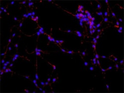 Invitrogen MAP2 Monoclonal Antibody (AP20) 50 &mu;L; Unconjugated:Antibodies,