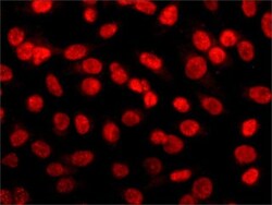 Invitrogen HDAC2 Monoclonal Antibody (HDAC2-62) 100 &mu;L; Unconjugated:Antibodies,