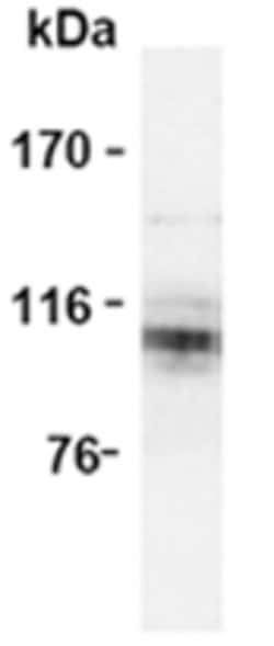 Invitrogen Amyloid Precursor Protein Monoclonal Antibody (3E9) 50 &mu;g;