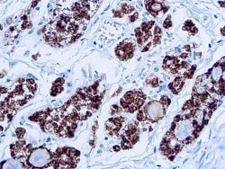 Invitrogen Thyroid Peroxidase Monoclonal Antibody (MoAb47) 250 &mu;L; Unconjugated:Antibodies,