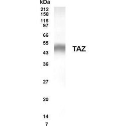 Invitrogen G-CSF Monoclonal Antibody (S1390) 250 &mu;g | Buy Online | Invitrogen&trade; | Fisher Scientific
