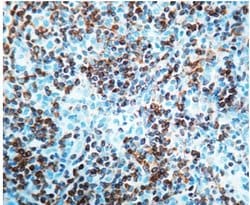 Invitrogen Bcl-2 Monoclonal Antibody (124) 250 &mu;L; Unconjugated:Antibodies,