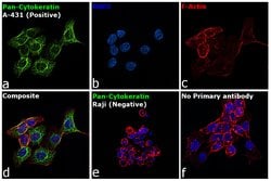 Invitrogen Cytokeratin 5/6/8/17/10 Monoclonal Antibody (MNF116) 500 &mu;L;