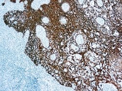 Invitrogen Cytokeratin 5/6/8/17/10 Monoclonal Antibody (MNF116) 500 &mu;L;