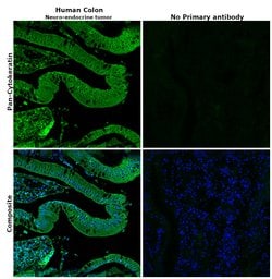 Invitrogen Cytokeratin 5/6/8/17/10 Monoclonal Antibody (MNF116) 500 &mu;L;
