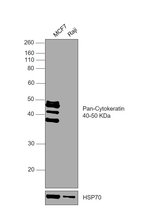 Invitrogen Cytokeratin 5/6/8/17/10 Monoclonal Antibody