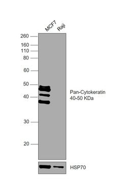 Invitrogen Cytokeratin 5/6/8/17/10 Monoclonal Antibody (MNF116) 500 &mu;L;