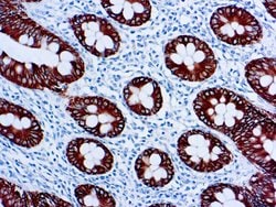 Invitrogen Cytokeratin 8 Monoclonal Antibody (35bH11) 500 &mu;L; Unconjugated:Antibodies,