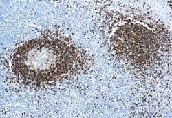 Invitrogen Hairy Cell Leukemia Monoclonal Antibody (DBA.44) 500 &mu;L | Buy Online | Invitrogen&trade; | Fisher Scientific