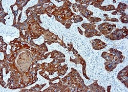 Invitrogen Cytokeratin Pan Type II Monoclonal Antibody (AE3) 6 mL; Unconjugated:Antibodies,