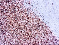 Invitrogen RPA2 Monoclonal Antibody (9H8) 500 &mu;L | Buy Online | Invitrogen&trade; | Fisher Scientific