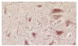 Invitrogen NMDAR3A/NMDAR3B Monoclonal Antibody (K35/40) 50 &mu;g; Unconjugated:Antibodies,