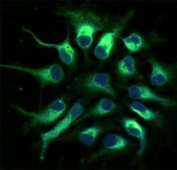 Invitrogen Nestin Monoclonal Antibody (3k1) 50 &mu;g; Unconjugated:Antibodies,